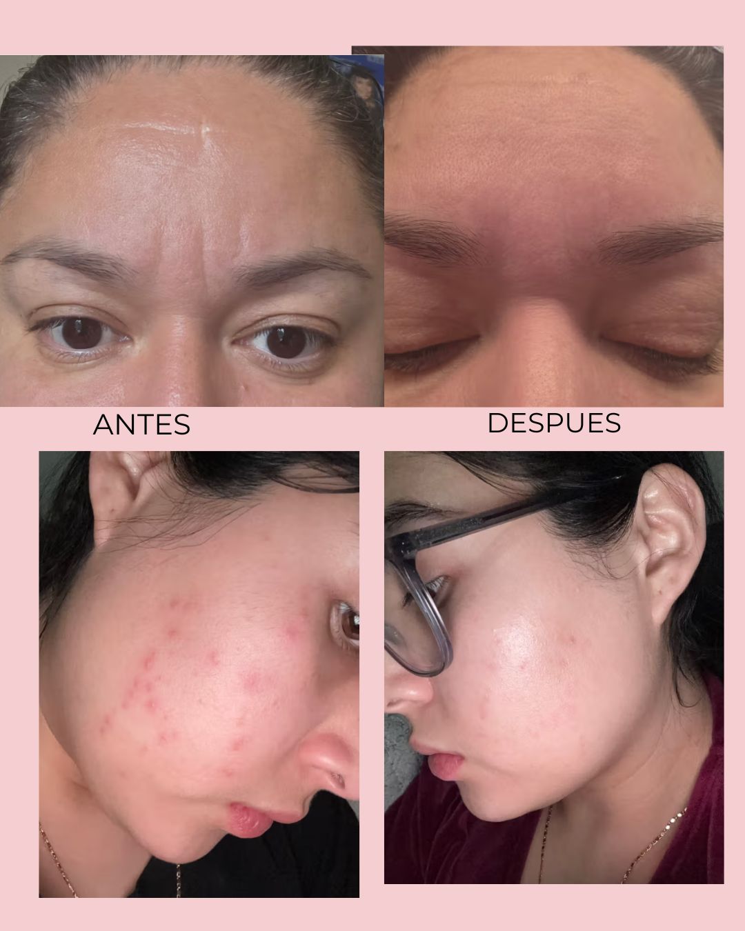 Medicube PDRN Pink Peptide Serum® Importado Original | Más Vendido en Corea para Tono Desigual, Piel Opaca y Falta de Firmeza